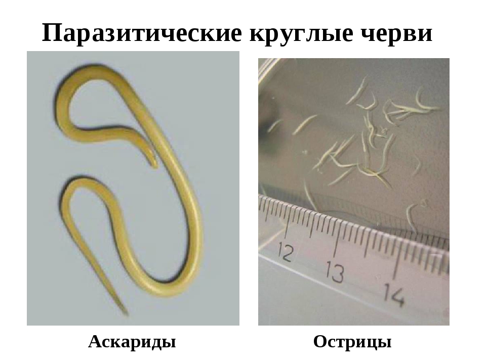 Как избавиться от нематод в аквариуме