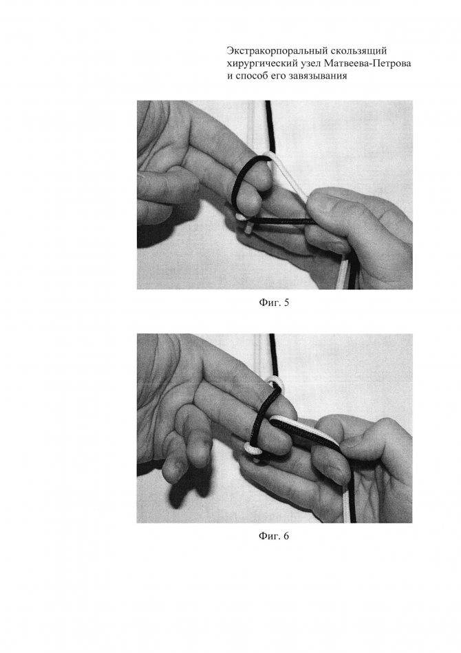 Хирургический узел: как завязать для фидера